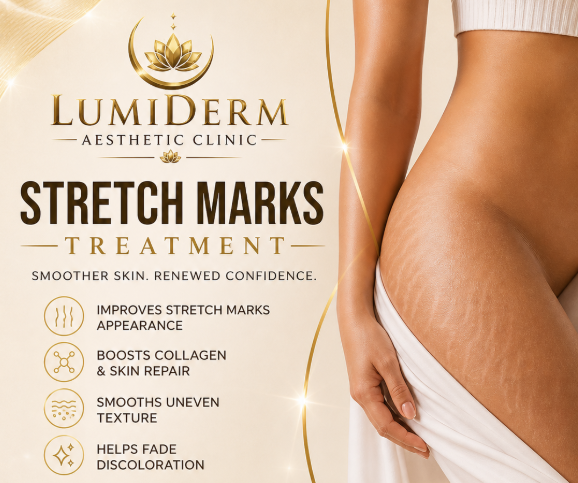 Stretch Marks Treatment with SQT